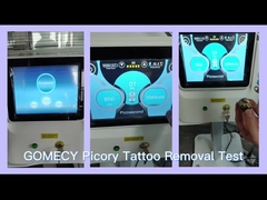 พิคอรี่