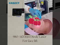 กลิ่นแพนเซีย เอ็นโดเลเซอร์ เอ็นโดลิฟท์